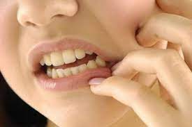 Itchy Gums After Flossing And Tooth Extraction